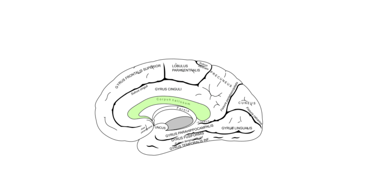 Die menschlichen Gehirnanatomie mit Beschriftungen der verschiedenen Regionen. Grün markiert das Corpus callosum.